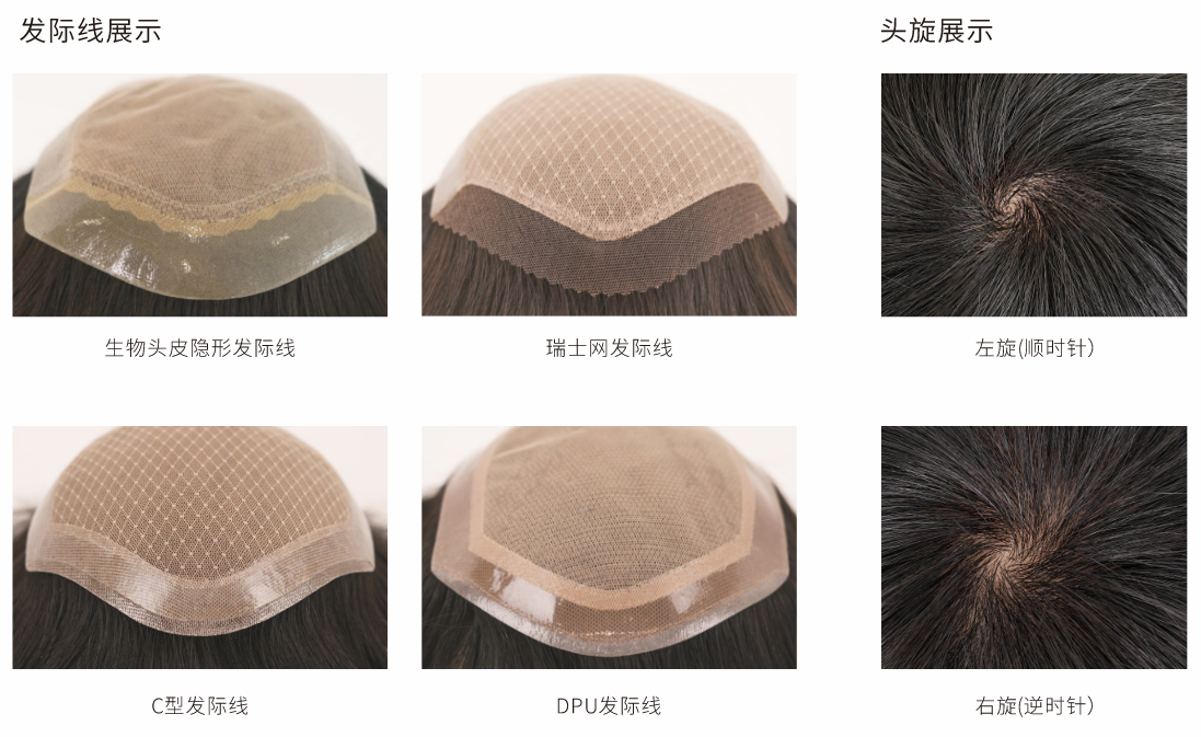 发际线类型与头旋方向定制图示